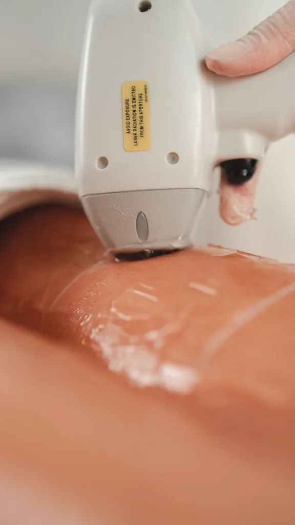 centre épilation laser